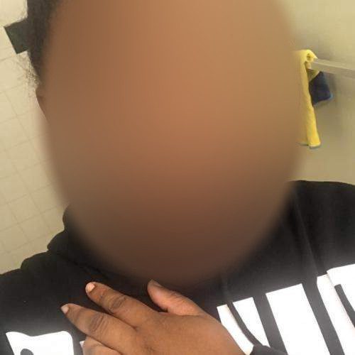 Hündin dringend mit Sperma in Stendal zu besamen